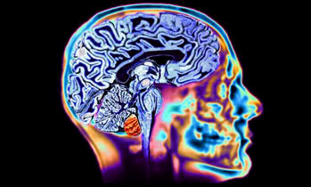 cerebro-humano